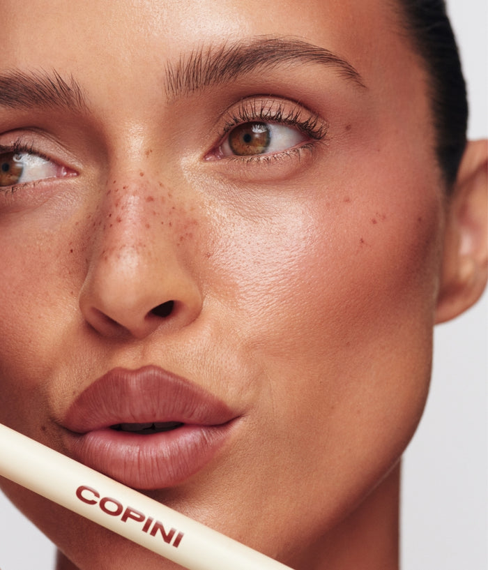 Freckle