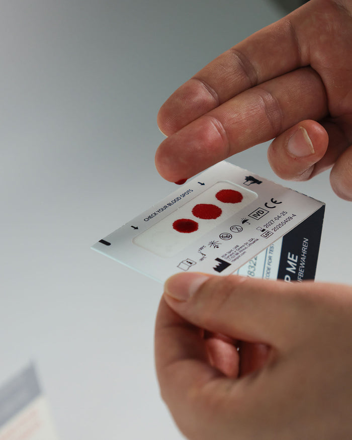 Vitamin D Test Anwendung